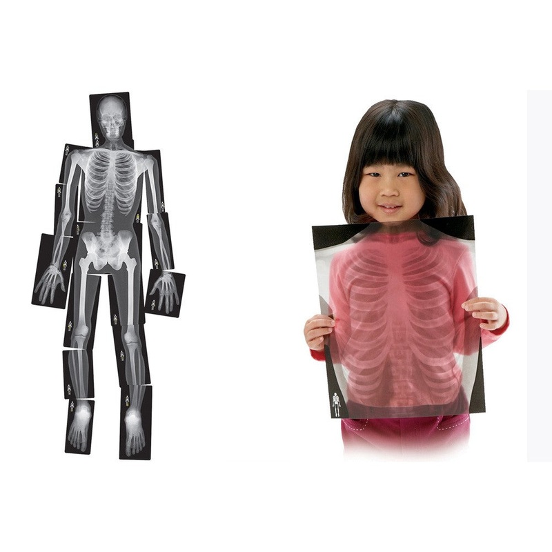 True to Life Human X-Rays